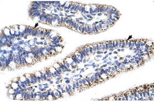 Immunohistochemical staining (Formalin-fixed paraffin-embedded sections) of human intestine with KLHL13 polyclonal antibody .