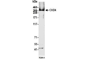 Western Blotting (WB) image for anti-Chromodomain Helicase DNA Binding Protein 4 (CHD4) (AA 50-100) antibody (ABIN7795622) (Rekombinanter CHD4 Antikörper  (AA 50-100))