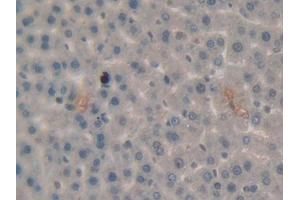 DAB staining on IHC-P; Samples: Rat Liver Tissue (PLG Antikörper  (AA 191-433))