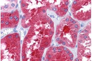 Human Kidney: Formalin-Fixed, Paraffin-Embedded (FFPE) (REEP3 Antikörper  (C-Term))