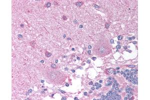 Immunohistochemistry (IHC) image for anti-Cholinergic Receptor, Nicotinic, beta 2 (Neuronal) (CHRNB2) (AA 21-70) antibody (ABIN6736368)