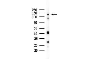 anti-RNA Binding Motif Protein 26 (RBM26) (Internal Region) antibody