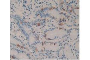 IHC-P analysis of Human Stomach Tissue, with DAB staining. (CCK8 Antikörper)