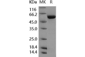 Western Blotting (WB) image for Transforming Growth Factor, beta Receptor 1 (TGFBR1) (AA 200-503) (Active) protein (GST tag,His tag) (ABIN7317107)