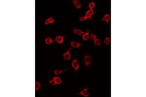 ABIN6267365 staining HepG2 by IF/ICC. (KIT Antikörper  (pTyr721))