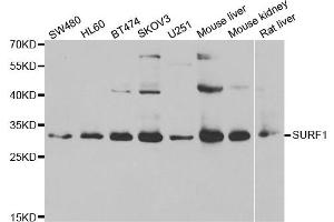 Western blot analysis of extracts of various cell lines, using SURF1 antibody. (SURF1 Antikörper)