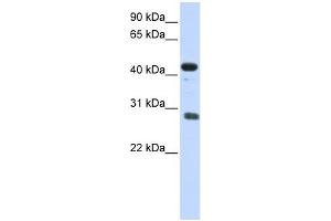CDCA5 antibody used at 1 ug/ml to detect target protein. (CDCA5 Antikörper  (Middle Region))