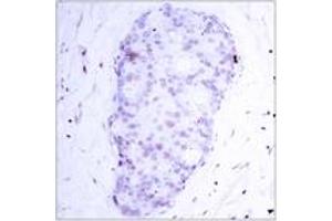 Immunohistochemistry (IHC) image for anti-Nuclear Factor of kappa Light Polypeptide Gene Enhancer in B-Cells 1 (NFKB1) (AA 874-923), (pSer907) antibody (ABIN1531922)