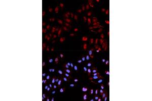 Immunofluorescence analysis of U2OS cells using Phospho-Histone H3-S28 antibody (ABIN5969937). (Histone H3.1 Antikörper  (pSer29))