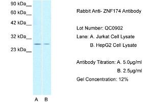 Host: Rabbit Target Name: ZNF174 Sample Type: Lane: A. (ZNF174 Antikörper  (N-Term))
