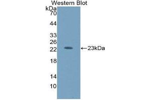 Western Blotting (WB) image for anti-Hexosaminidase B (Beta Polypeptide) (HEXB) (AA 122-311) antibody (ABIN3208194) (HEXB Antikörper  (AA 122-311))