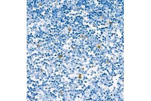 Immunohistochemistry analysis of paraffin embedded mouse thymus using CA13 (ABIN7073310) at dilution of 1: 400 (CA13 Antikörper)