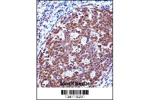 ZAP70 Antibody immunohistochemistry analysis in formalin fixed and paraffin embedded human tonsil tissue followed by peroxidase conjugation of the secondary antibody and DAB staining. (ZAP70 Antikörper  (AA 276-304))