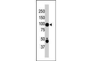 The MAP4K2 polyclonal antibody  is used in Western blot to detect MAP4K2 in mouse skeletal muscle tissue lysate . (MAP4K2 Antikörper  (Internal Region))