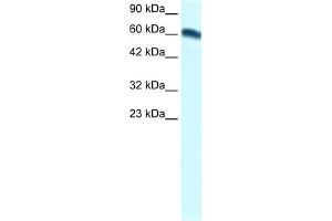 WB Suggested Anti-FOXC2 Antibody Titration:  1. (FOXC2 Antikörper  (Middle Region))