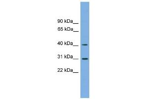 Western Blotting (WB) image for anti-Hydroxy-delta-5-Steroid Dehydrogenase, 3 beta- and Steroid delta-Isomerase 7 (HSD3B7) (Middle Region) antibody (ABIN2783973)