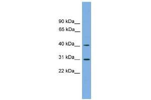 WB Suggested Anti-HSD3B7 Antibody Titration:  0. (HSD3B7 Antikörper  (Middle Region))