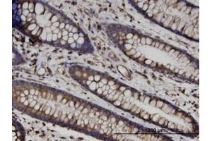 Image no. 1 for anti-Tubulin, beta (TUBB) (AA 1-445) antibody (ABIN599619) (TUBB Antikörper  (AA 1-445))