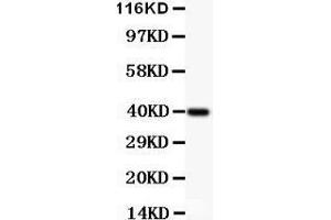 Anti-IKK alpha Picoband antibody,  All lanes: Anti IKKA  at 0. (IKK alpha Antikörper  (AA 411-745))