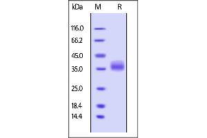 Human Galectin-3, His Tag on  under reducing (R) condition.