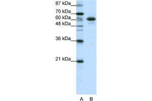 Western Blotting (WB) image for anti-Cas-Br-M (Murine) Ecotropic Retroviral Transforming Sequence-Like 1 (CBLL1) antibody (ABIN2461939)