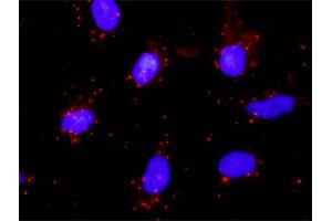 Proximity Ligation Assay (PLA) image for anti-PTK2 Protein tyrosine Kinase 2 (PTK2) (AA 355-490) antibody (ABIN562519)