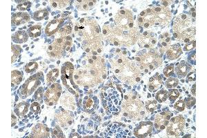 PPIE antibody was used for immunohistochemistry at a concentration of 4-8 ug/ml to stain Epithelial cells of renal tubule (arrows) in Human Kidney. (PPIE Antikörper)