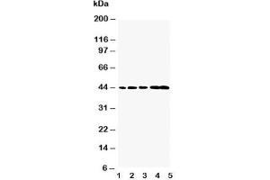 Western blot testing of Caspase-1 antibody and Lane 1:  rat brain;  2: rat spleen;  3: mouse brain;  4: mouse spleen;  5: mouse testis (Caspase 1 Antikörper  (N-Term, Subunit p20))
