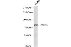 Western blot analysis of extracts of HL-60 cells, using  antibody (ABIN6134210, ABIN6136382, ABIN6136383 and ABIN6224696) at 1:1000 dilution.