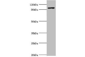 Western blot All lanes: TAF1C antibody at 2 μg/mL + 293T whole cell lysate Secondary Goat polyclonal to rabbit IgG at 1/10000 dilution Predicted band size: 96, 85, 59, 50, 93 kDa Observed band size: 96 kDa (TAF1C Antikörper  (AA 70-320))