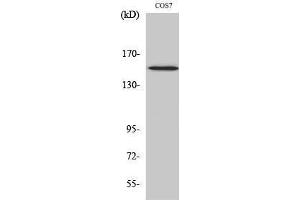 Western Blotting (WB) image for anti-phospholipase C, gamma 1 (PLCG1) (pTyr771) antibody (ABIN3173207) (Phospholipase C gamma 1 Antikörper  (pTyr771))