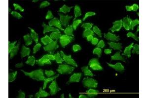 Image no. 1 for anti-3'(2'), 5'-Bisphosphate Nucleotidase 1 (BPNT1) (AA 1-101) antibody (ABIN599133) (BPNT1 Antikörper  (AA 1-101))