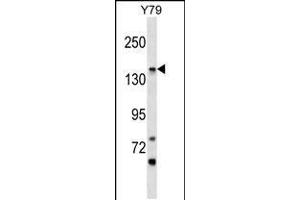 Western blot analysis in Y79 cell line lysates (35ug/lane). (PIGO Antikörper  (C-Term))