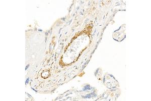 Immunohistochemistry of paraffin-embedded human placenta using TAGLN Rabbit pAb (ABIN6128763, ABIN6148829, ABIN6148830 and ABIN6222495) at dilution of 1:25 (40x lens). (Transgelin Antikörper  (AA 1-201))