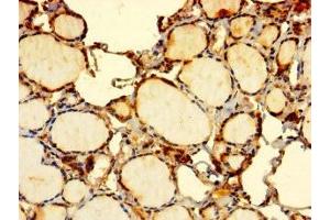 Immunohistochemistry of paraffin-embedded human thyroid tissue using ABIN7151974 at dilution of 1:100 (EDEM2 Antikörper  (AA 22-300))