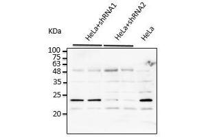 Western Blotting (WB) image for anti-RAB7A, Member RAS Oncogene Family (RAB7A) (C-Term) antibody (ABIN6254195)