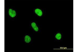 Immunofluorescence of purified MaxPab antibody to UBE2S on HeLa cell. (UBE2S Antikörper  (AA 1-222))