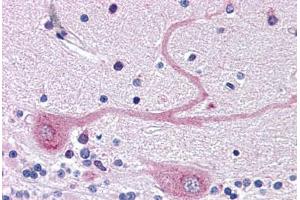 Human Brain, Cerebellum (formalin-fixed, paraffin-embedded) stained with ARMET antibody ABIN343894 at 5 ug/ml followed by biotinylated goat anti-rabbit IgG secondary antibody ABIN481713, alkaline phosphatase-streptavidin and chromogen. (MANF Antikörper  (C-Term))