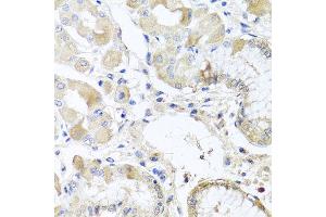 Immunohistochemistry of paraffin-embedded human gastric using RPL36 antibody at dilution of 1:100 (x40 lens).