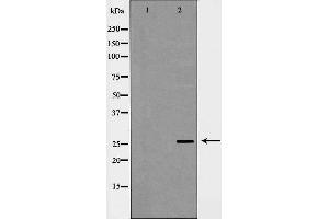 Western blot analysis of extracts of mouse liver, using C1QB antibody. (C1QB Antikörper  (Internal Region))