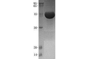 Western Blotting (WB) image for Cathepsin E (CTSE) (Transcript Variant 1) protein (His tag) (ABIN2713235)