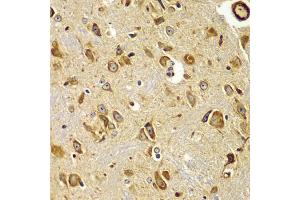 Immunohistochemistry of paraffin-embedded mouse brain using SMAD9 antibody (ABIN5975592) at dilution of 1/100 (40x lens). (SMAD9 Antikörper)