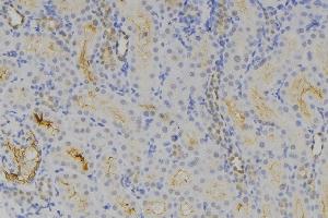 ABIN6275435 at 1/100 staining Human lymph node tissue by IHC-P.