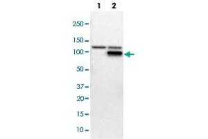 Western blot analysis of Lane 1: NIH-3T3 cell lysate (Mouse embryonic fibroblast cells); Lane 2: NBT-II cell lysate (Rat Wistar bladder tumour cells) with PFKM polyclonal antibody  at 1:100-1:250 dilution. (PFKM Antikörper)