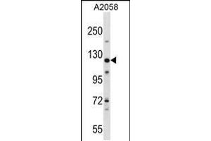 Western blot analysis in A2058 cell line lysates (35ug/lane). (BAT3 Antikörper  (C-Term))
