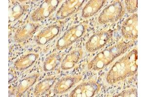 Immunohistochemistry of paraffin-embedded human small intestine tissue using ABIN7176385 at dilution of 1:100 (ZNF562 Antikörper  (AA 201-426))
