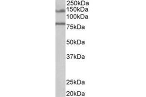 AP31721PU-N EPB41L5 antibody staining of Human Brain (Hippocampus) lysate at 1 µg/ml (35 µg protein in RIPA buffer). (EPB41L5 Antikörper  (Internal Region))