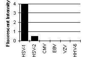 Cross Reactivity Results determined by IFA (HSV-1 gC Antikörper)