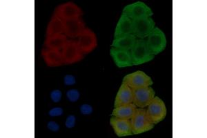 ABIN6262527 and ABIN6278482 staining Hela cells(30 min of UV treatment) by IF/ICC. (IL32 Antikörper  (Internal Region))