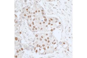 Immunohistochemistry (IHC) image for anti-Leo1, Paf1/RNA Polymerase II Complex Component, Homolog (S. Cerevisiae) (LEO1) (AA 550-600) antibody (ABIN7453950)